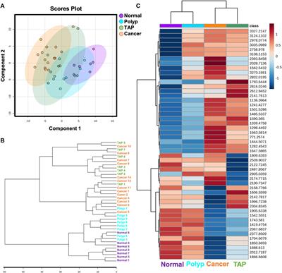 Utilizing multimodal mass spectrometry imaging for profiling immune cell composition and N-glycosylation across colorectal carcinoma disease progression